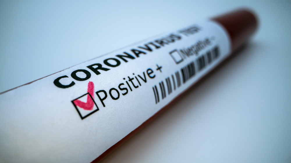 Foto de um exame de sangue indicando positivo para Coronavirus.