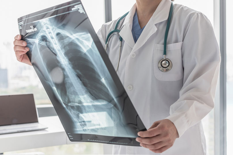 16---5ª-Turma-do-TRT-RS-nega-indenização-a-trabalhador-que-contraiu-tuberculose.jpg