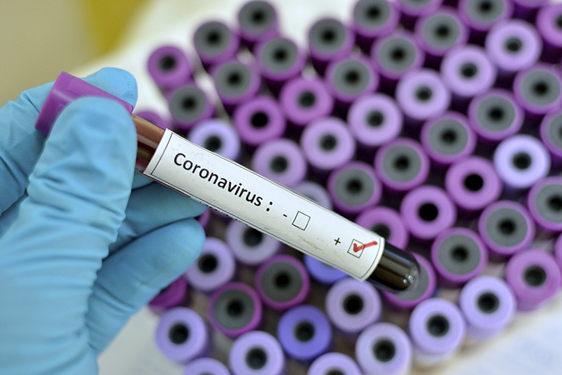 28-coronavirus.jpg