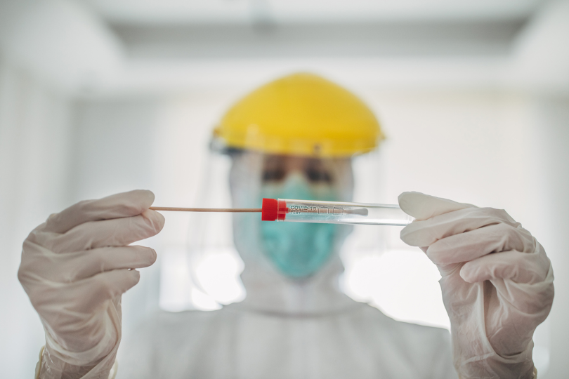 Foto ilustrativa de um técnico realizando um teste de RT-PCR