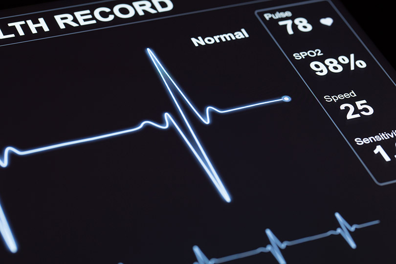 Pra Cego Ver: foto de mkurtbas/iStock Banco de Imagens mostra um monitor de exame de eletrocardiograma