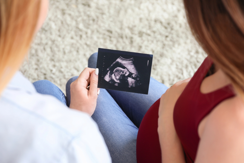Duas mulheres olham para uma imagem de ultrassom, na qual aparece um feto. Elas têm a pele e cabelos claros, longos e lisos. Estão sentadas, uma ao lado da outra. Uma delas está grávida e com a mão sobre a barriga. Não há imagem dos rostos.