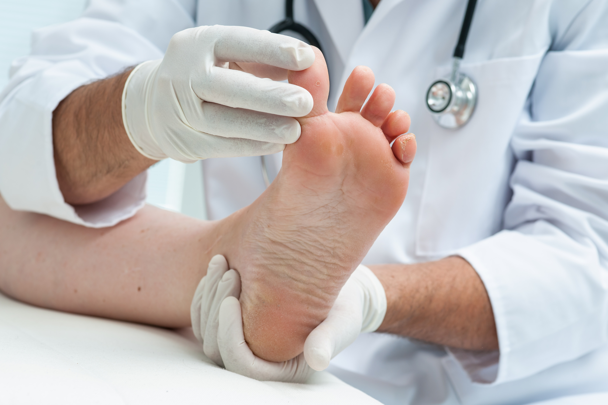 médico de jaleco branco examina o pé de um homem. médico de jaleco branco examina o pé de um homem.