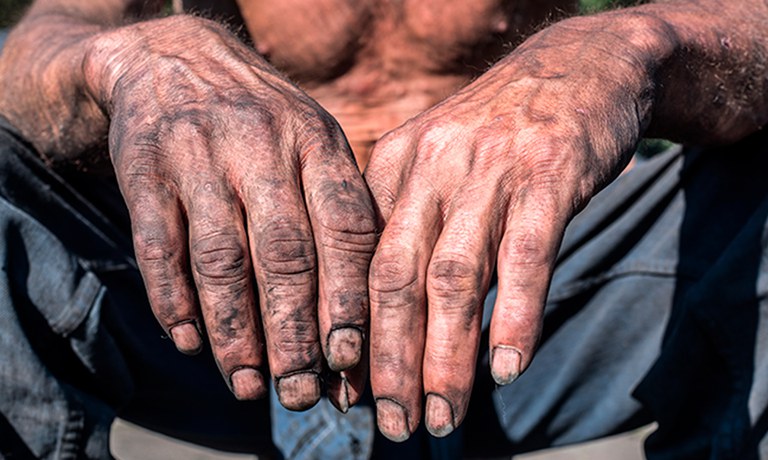 Foto, em ângulo fechado, de mãos sujas de um homem.